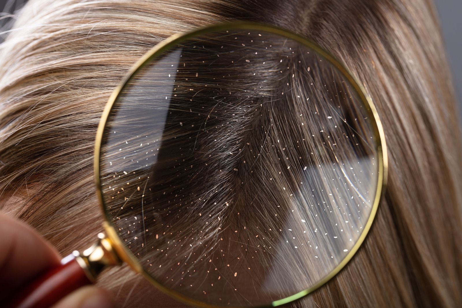 Что такое лупа волосы